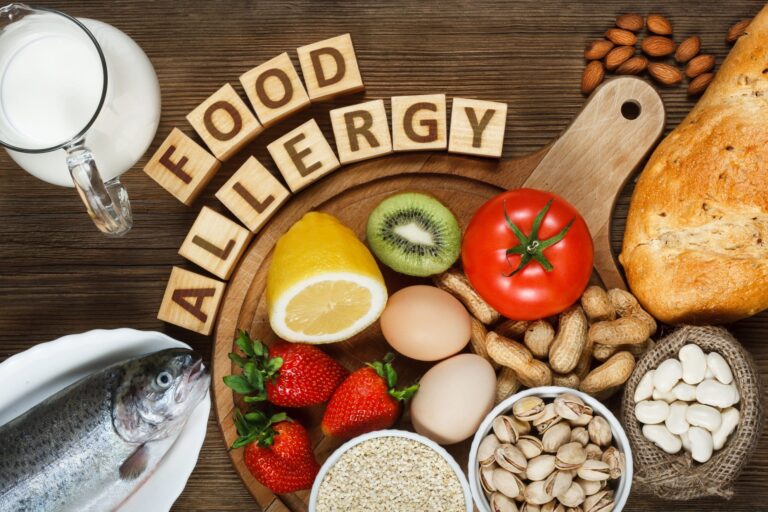 Eight foods that cause 90% of all food allergies.